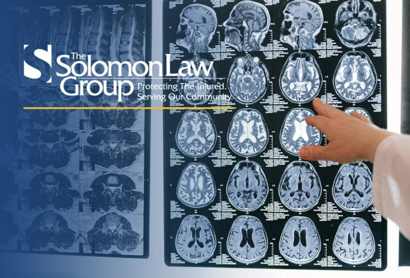 Can you ever full recover from brain personal injury